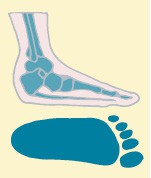 flatfooted